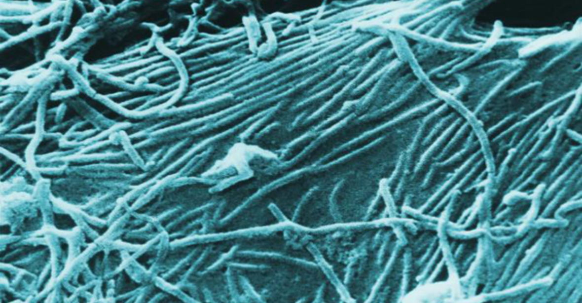 USA hlásí první případ výskytu eboly na svém území