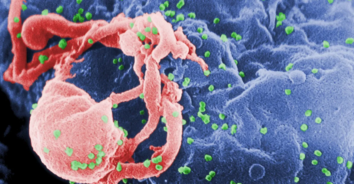 Rusko zanedbává boj s AIDS. Hrozí epidemie, varuje expert