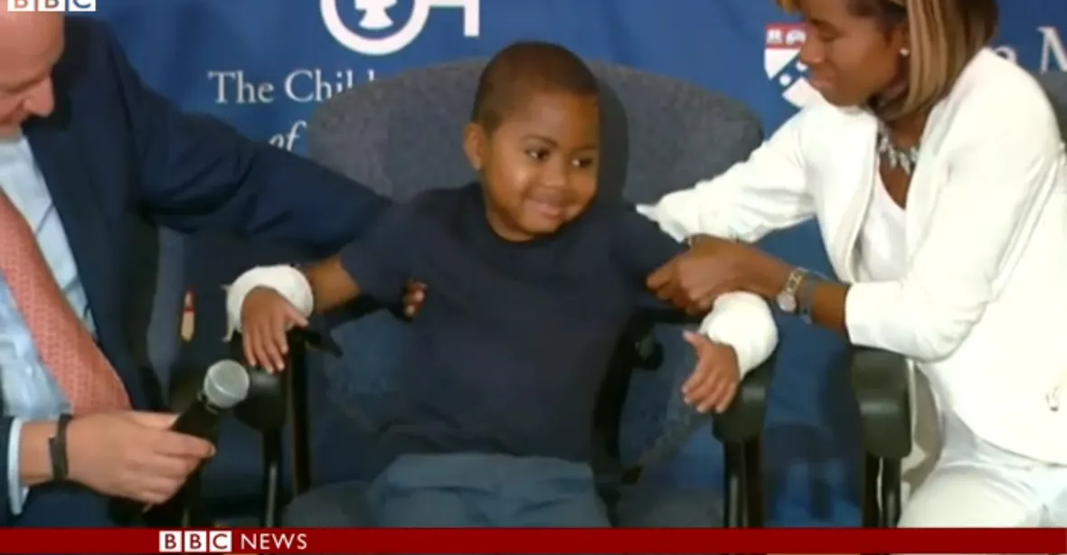 Malý zázrak: osmiletému chlapci transplantovali obě ruce