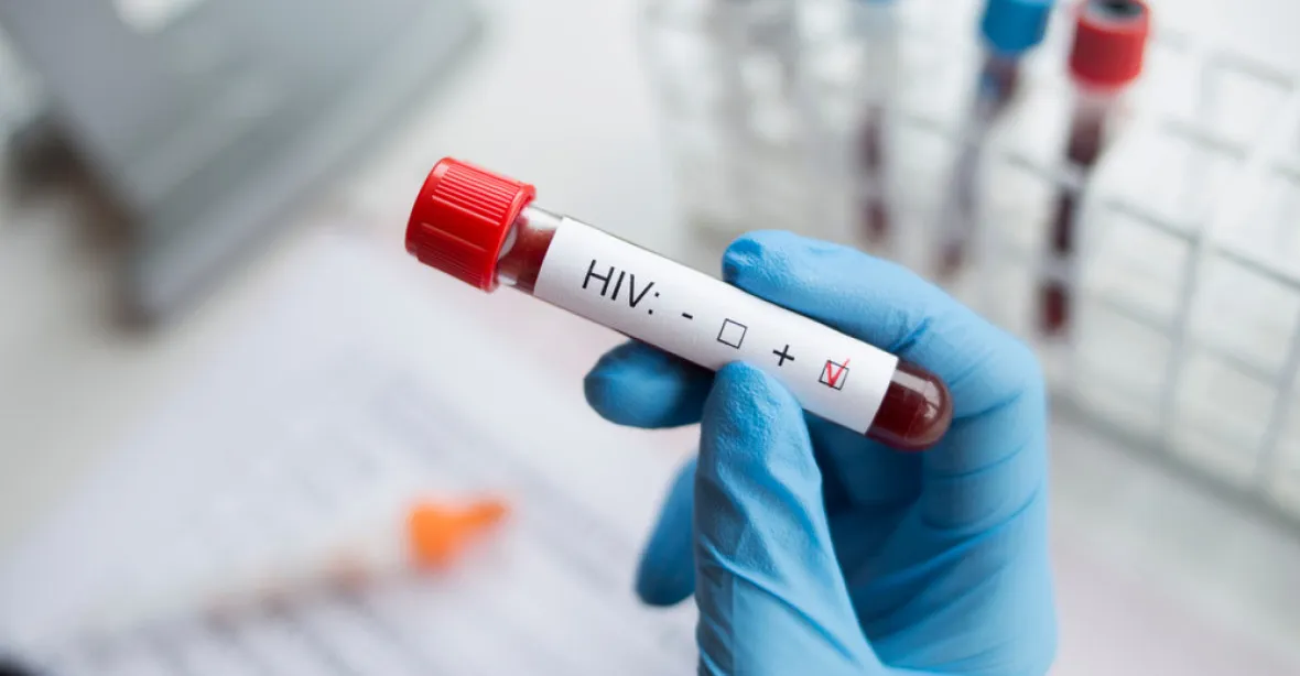 Půlku nových případů HIV tvoří cizinci, celkově se výskyt snížil