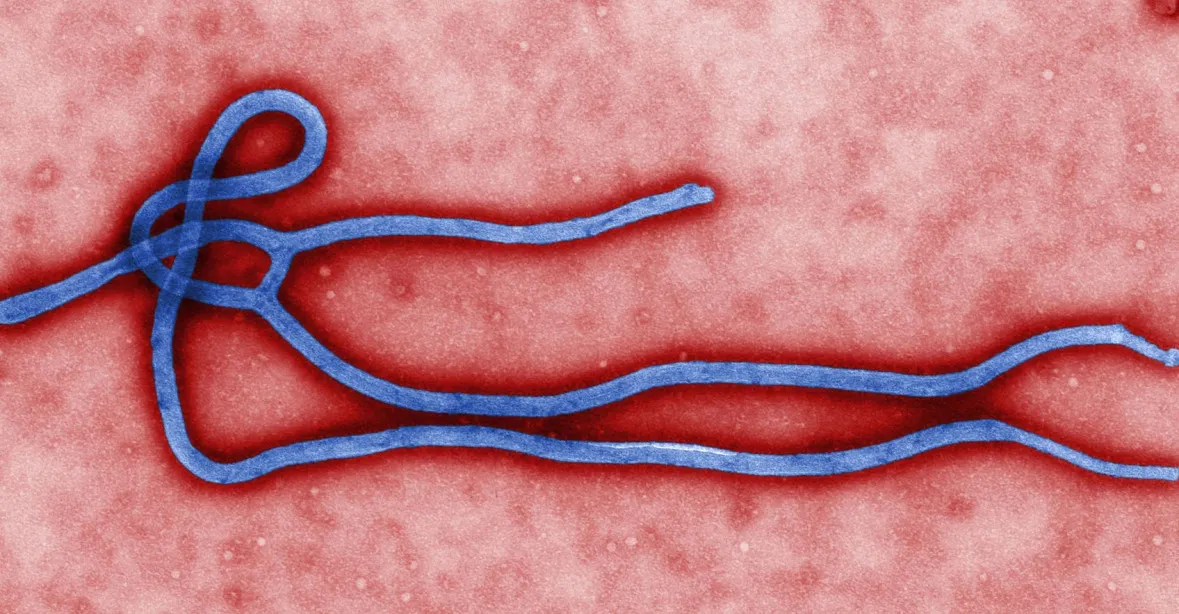 Zázračný lék na ebolu? Američany vyléčilo netestované sérum