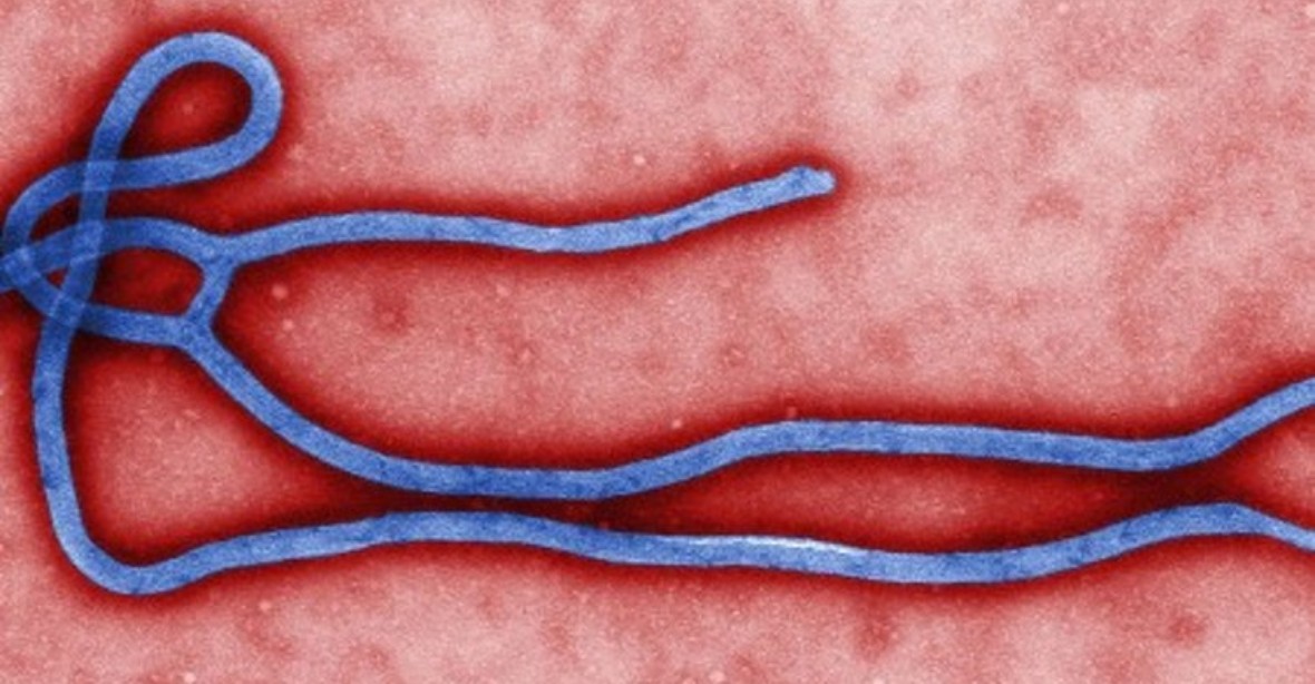 Zastaví se léčba eboly? Výrobce experimentálního léku hlásí konec zásob