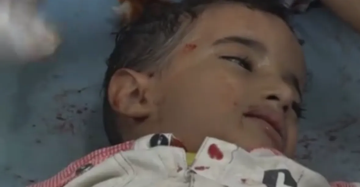 Nepohřbívejte mě! prosí chlapec. Symbol utrpení v Jemenu