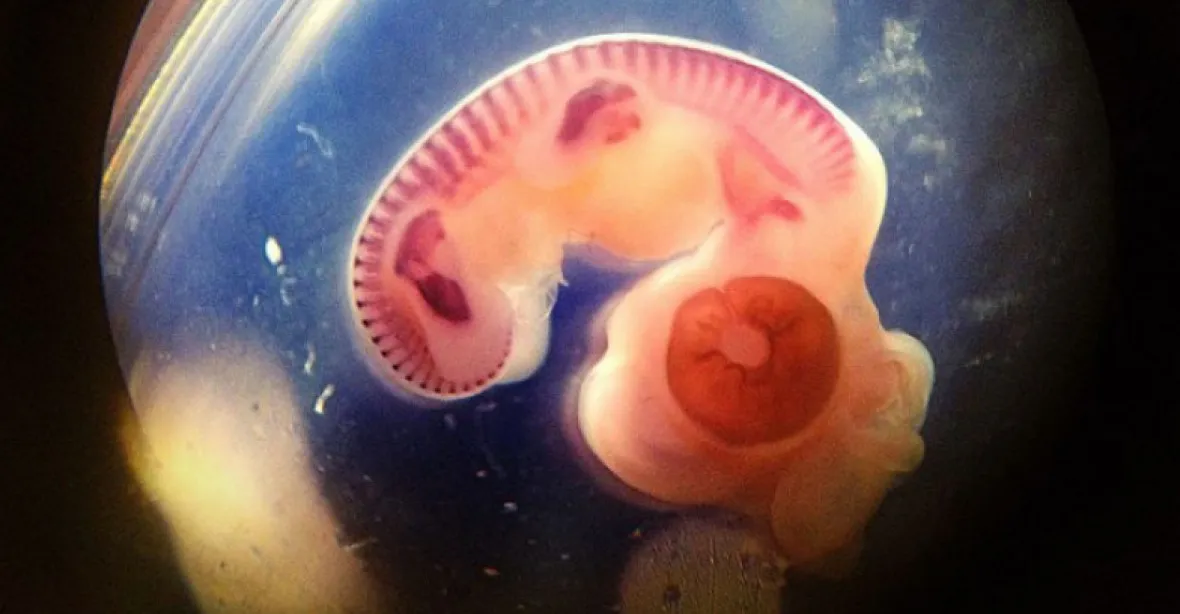 Čínští vědci údajně geneticky modifikovali lidská embrya. Vláda jejich práci zastavila