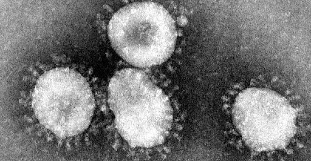 Počet nakažení novým koronavirem přesáhl dvě stovky. Tři lidé už umřeli