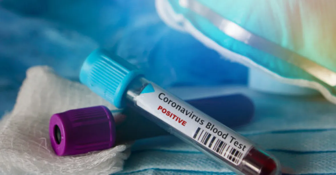 Česko prověřuje 3 pacienty kvůli podezření nákazy koronavirem. Všichni byli v Číně
