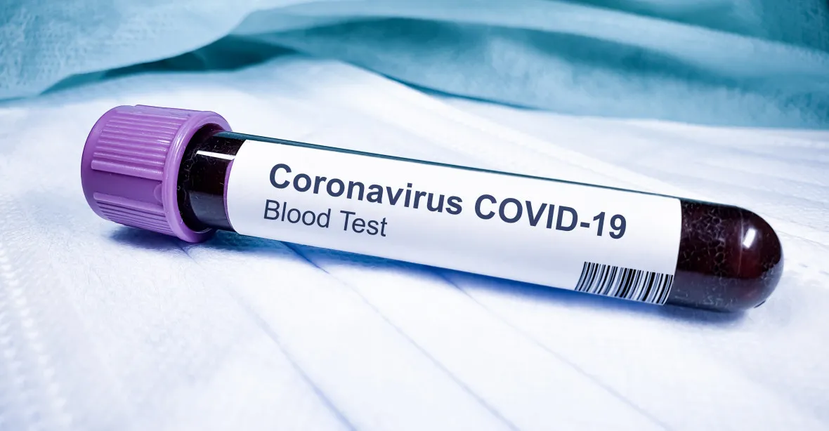 Počet nakažených koronavirem stoupl v Česku na 12