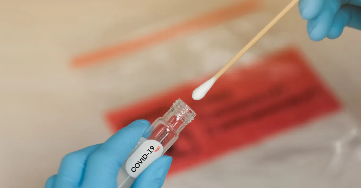 Vídenští vědci přišli s levným testem na koronavirus, vyhodnotit ho lze pouhým pohledem