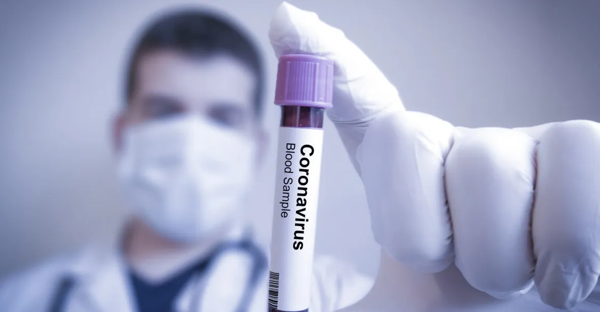 Raketový nárůst případů koronaviru v Česku. Poprvé přesáhl 500 za den