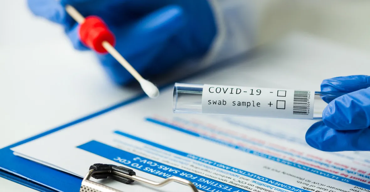 Domácí test na covid-19 v Česku neexistuje, upozorňují odborníci