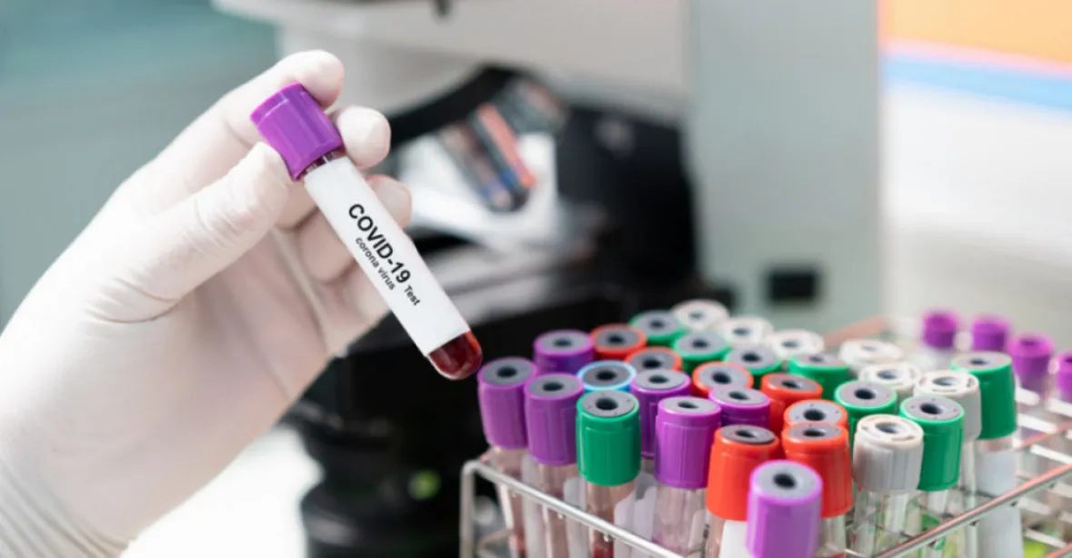 V Česku je potvrzeno 120 případů vysoce nakažlivé indické mutace koronaviru