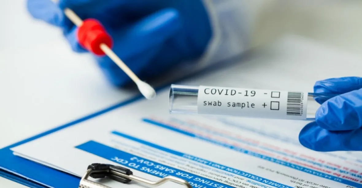 Pátečních 20.315 případů koronaviru bylo o desetinu méně než před týdnem