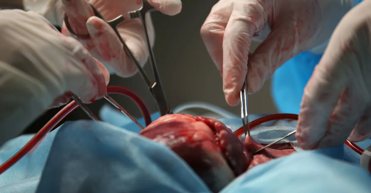 Naděje pro statisíce. Lékaři z USA transplantovali člověku srdce z prasete
