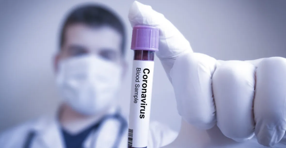 V pondělí testy v ČR odhalily 1297 případů koronaviru, podobně jako před týdnem