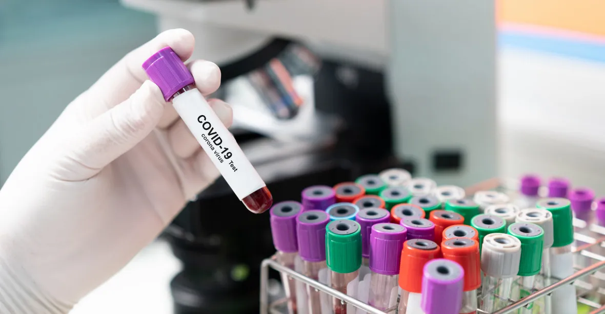 FBI se kloní k teorii o úniku koronaviru z laboratoře